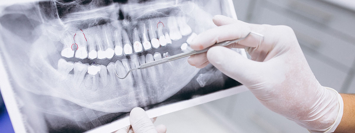 به کمک هوش مصنوعی مرحله حدس بیماری توسط دندان پزشکان از میان برداشته میشود