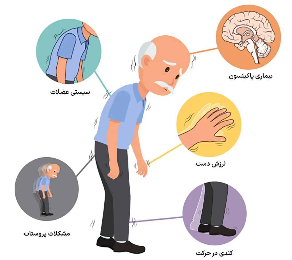 علائم بیماری پارکینسون